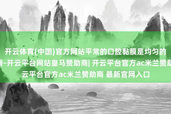 开云体育(中国)官方网站平常的口腔黏膜是均匀的粉红色、柔嫩光滑-开云平台网站皇马赞助商| 开云平台官方ac米兰赞助商 最新官网入口